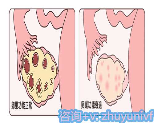 选择一家优质的供卵试管服务,助您实现生育梦想