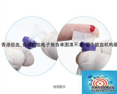 hk 香港验血_香港验血电子报告单图准不准,哪个验血机构最准