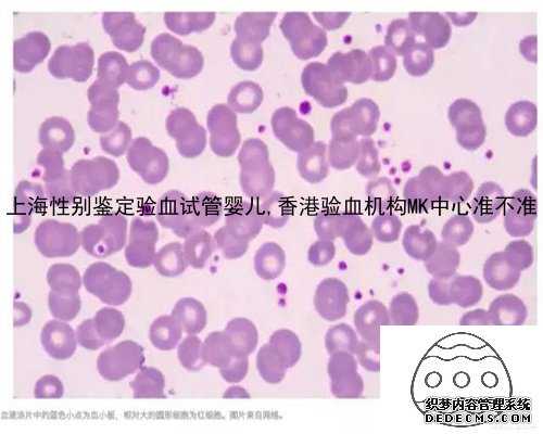 上海性别鉴定验血试管婴儿,香港验血机构MK中心准不准