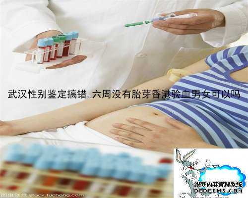 武汉性别鉴定搞错,六周没有胎芽香港验血男女可以吗
