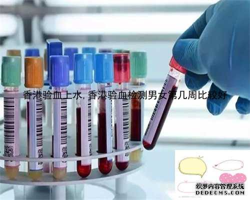香港验血上水,香港验血检测男女第几周比较好
